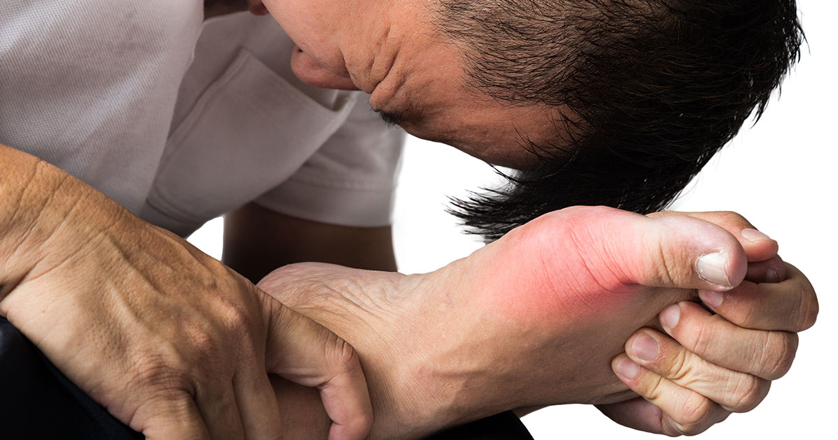 What’s Gout? Can we prevent it?